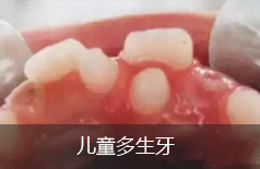 多生牙
