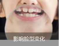 影响脸型变化