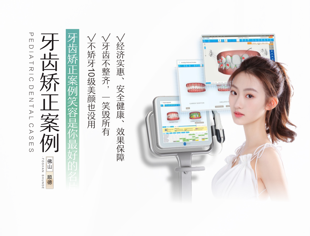 牙齿矫正案例